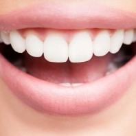 dientes-blancos-29159_1_780x462