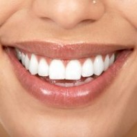 irrigador dental barato