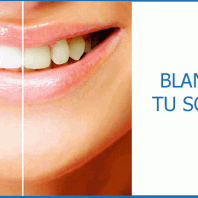 Blanqueamiento dental